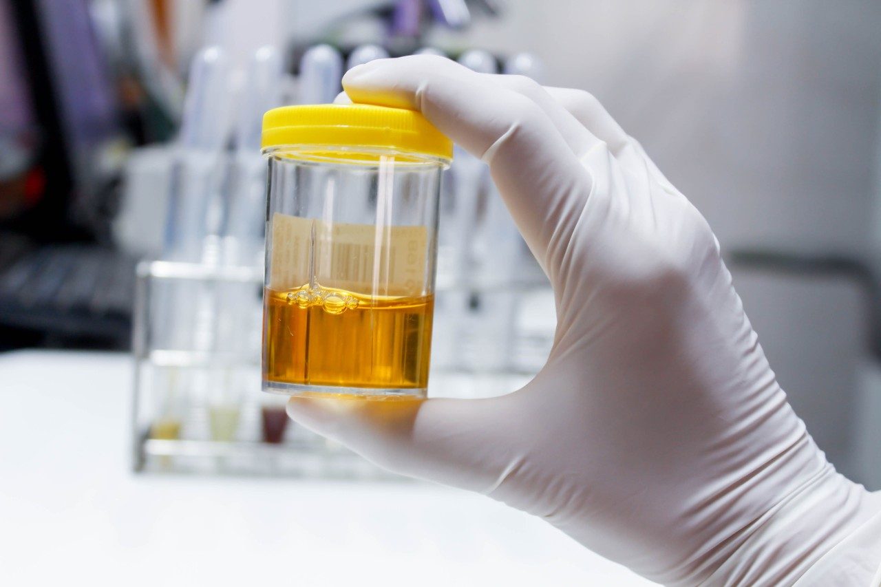 Urine sample in cup in gloved hand in lab