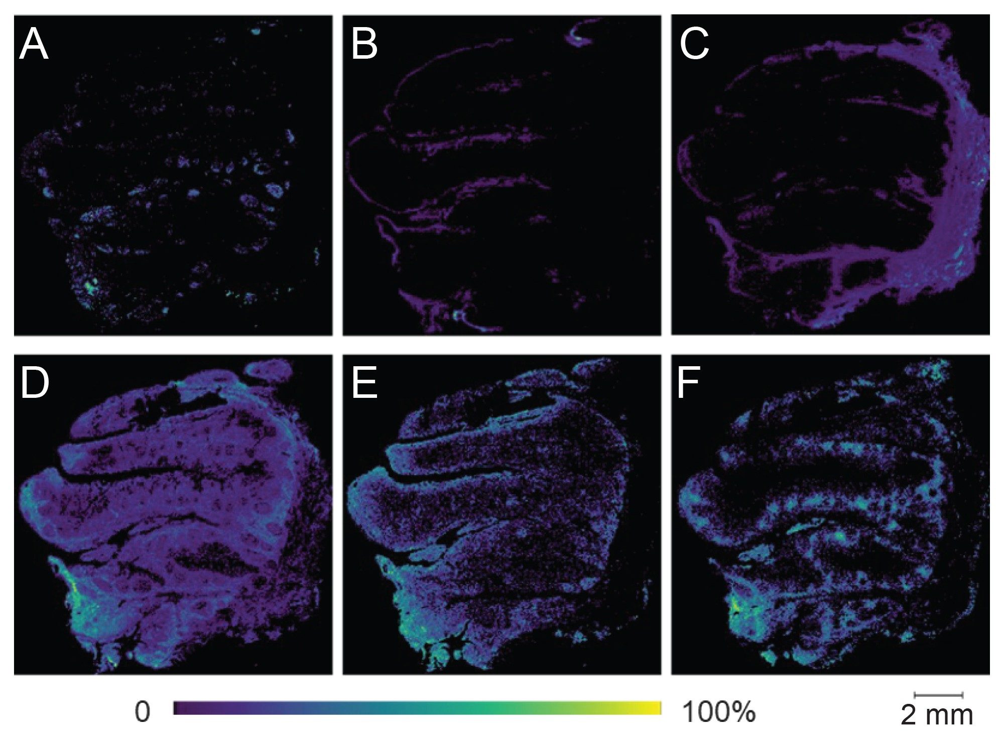 Results of MALDI analysis of pre-stained human tonsil FFPE section at 50 µm pixel size