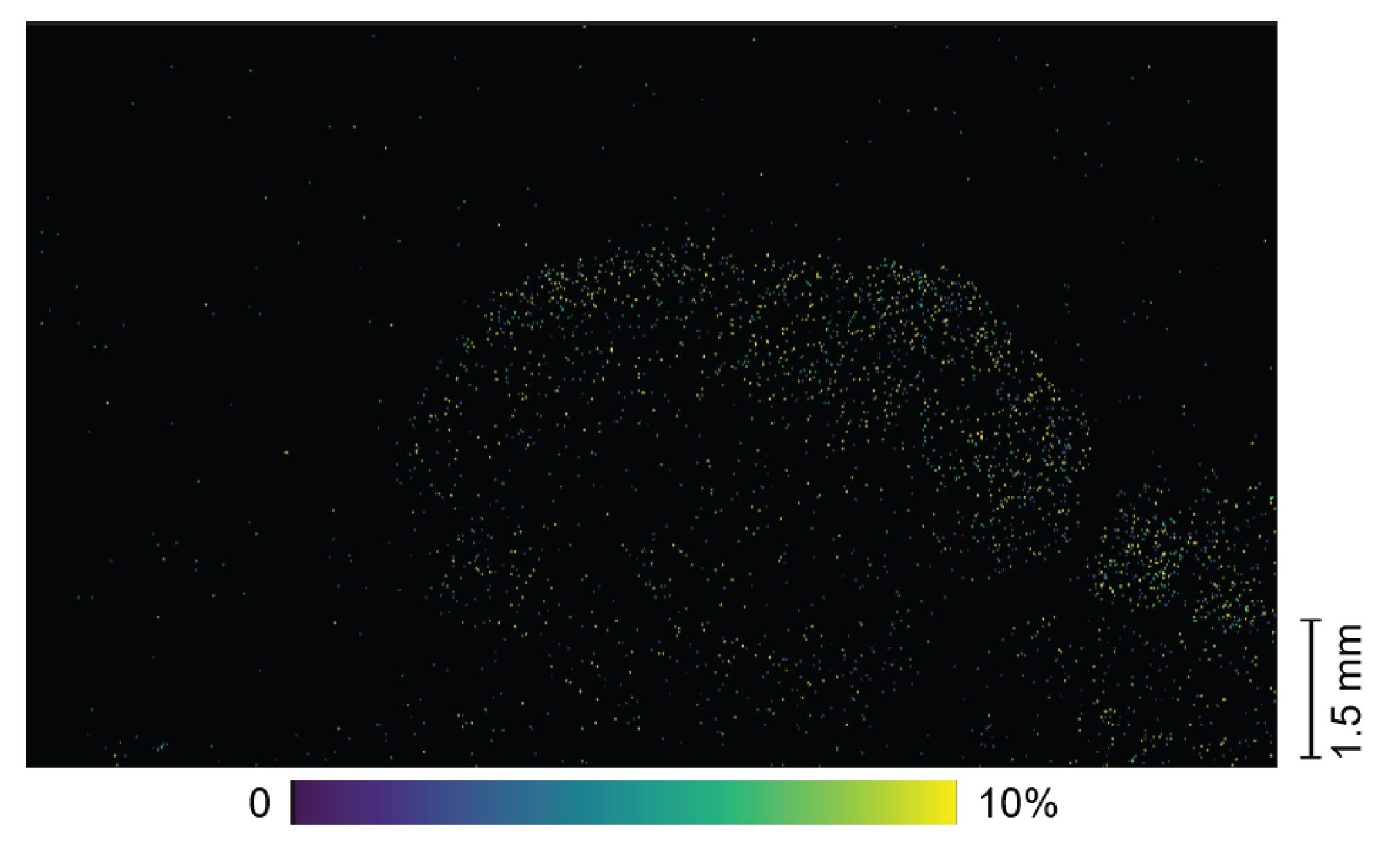 Ki67 located to individual 20 µm pixels, increased localization is seen within the tumor tissue suggesting rapid cellular proliferation