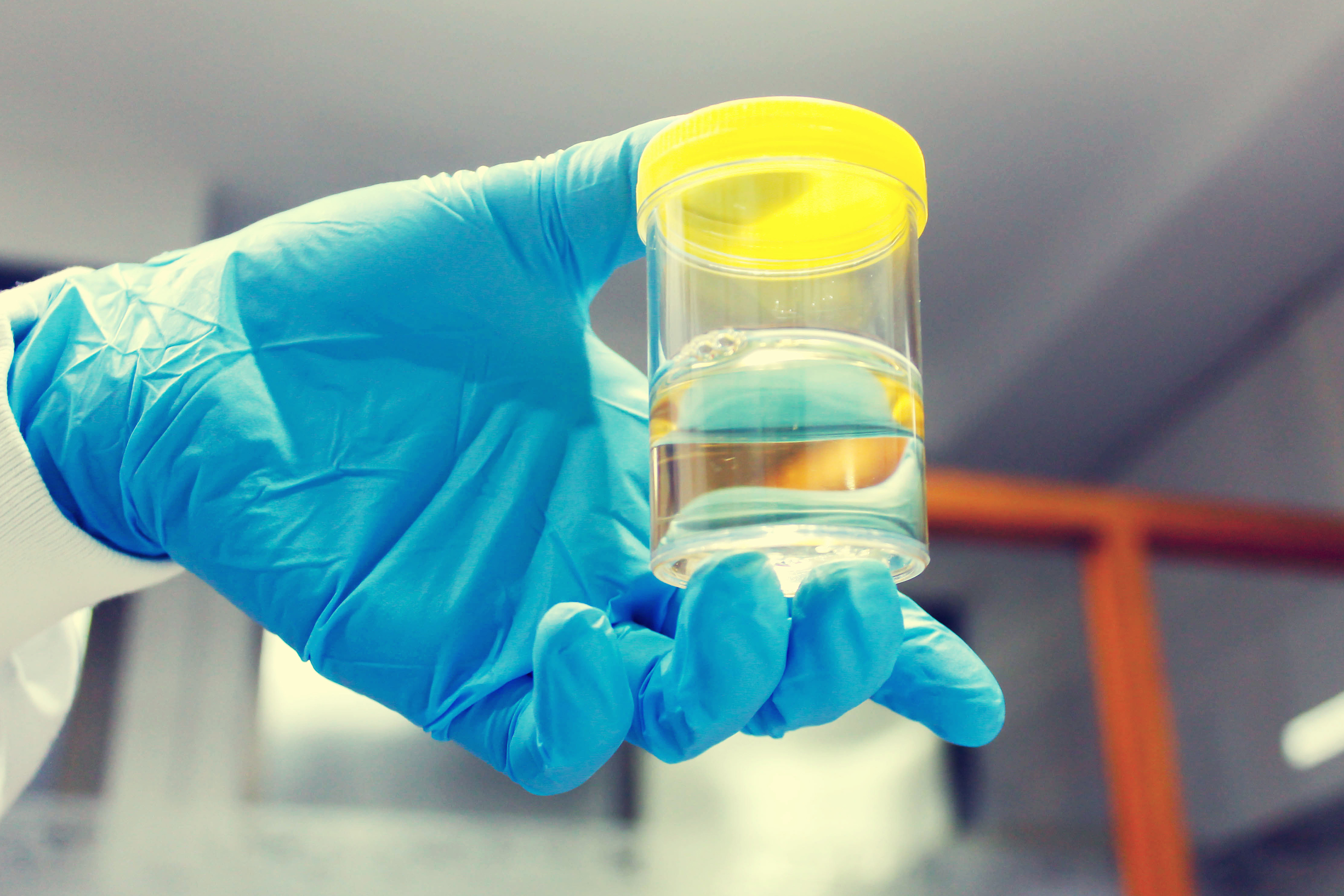 Médico sujetando una muestra de orina en un laboratorio